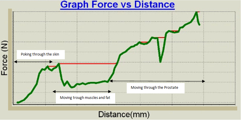 Graphique en temps réel (Banc d'essai du dispositif de fantôme de prostate) - de la force en fonction de la profondeur de pénétration de l'aiguille.