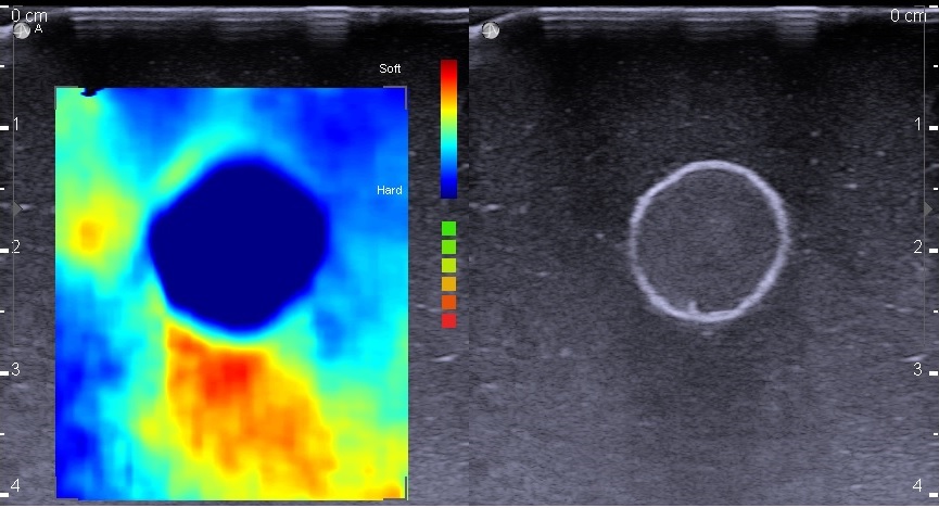 Breast Phantom Elastography colored image jpg