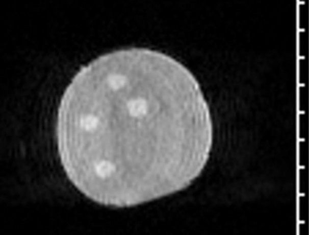 Breast Phantom Mammography