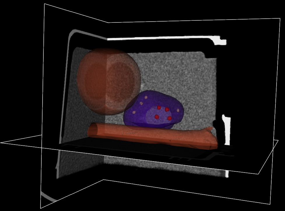 CT dataset 6 surfaces with 4 1mm-diameter and 4 2mm-diameter markers png