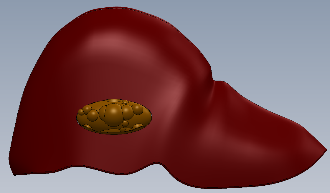 FIGURE1-LIVER.png Cancerous Ultrasound Liver Phantom with Gallbladder, Liver Phantom, Gallbladder Phantom