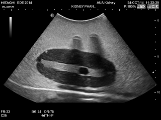 Kidney Phantom image png
