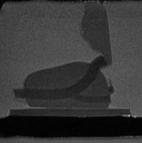 Sagittal MRI view of the Prostate Phantom 1