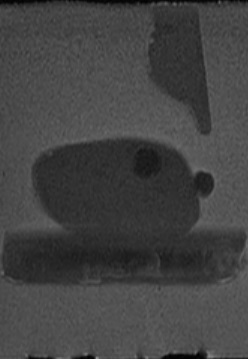 Sagittal MRI view of the Prostate Phantom 2