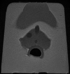 MRI6.jpg