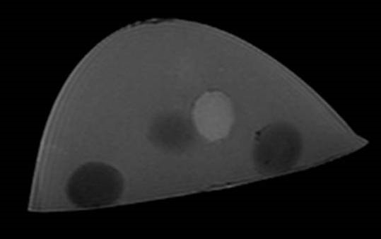 Multimodality Breast Phantom MRI 1