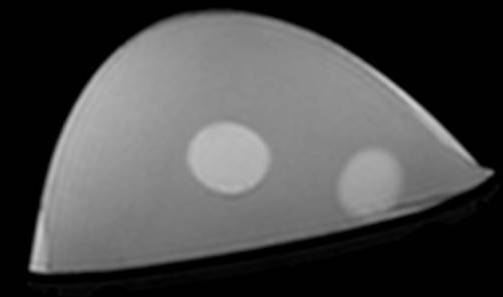 Multimodality Breast Phantom MRI 2