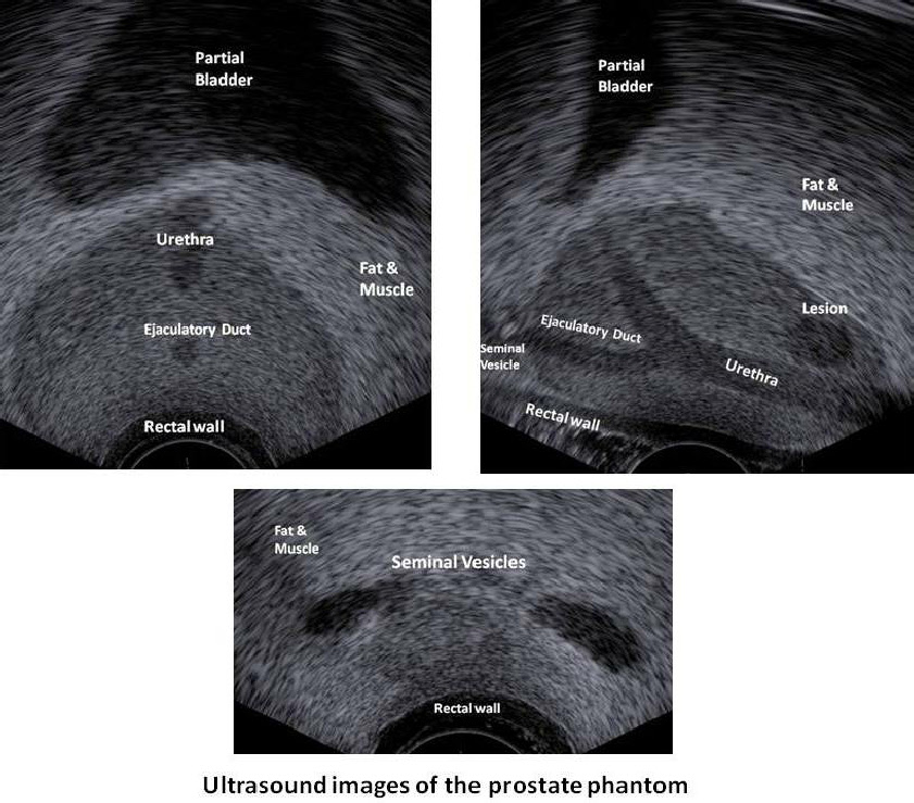 Side Fire Prostate Phantom us images png