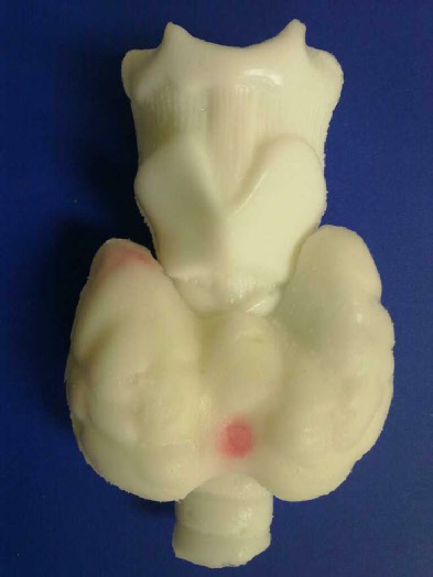 Thyroid Phantom