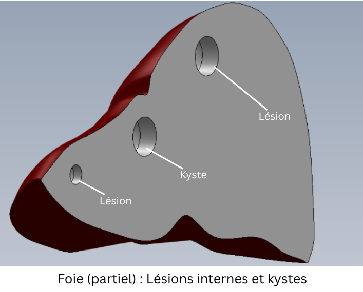 liver