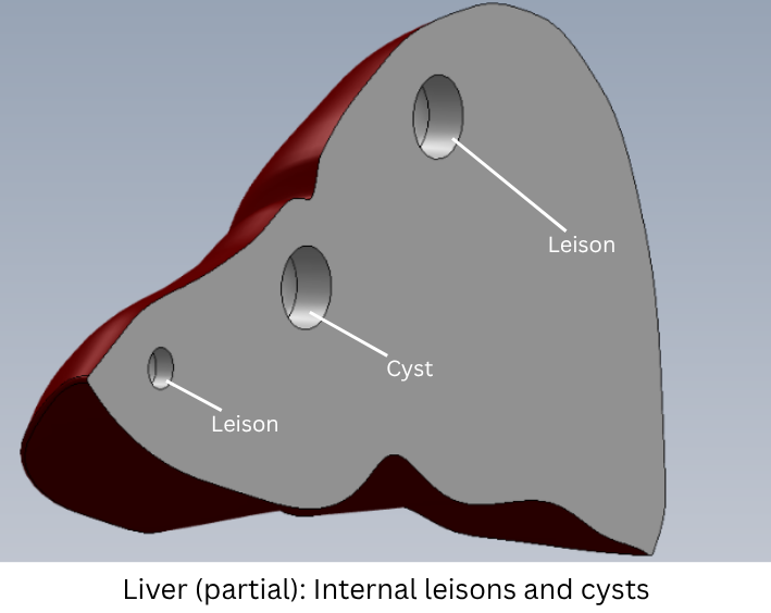 liver